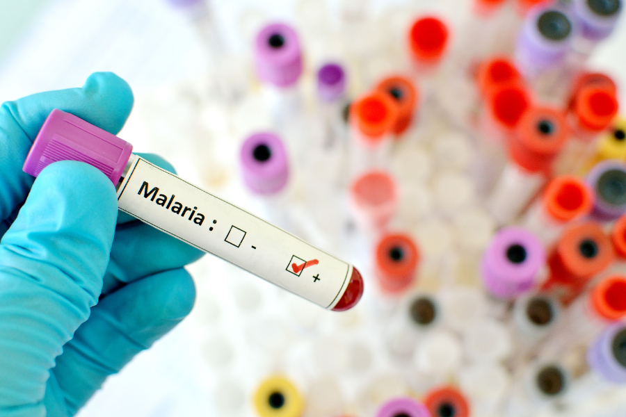 Anticuerpo monoclonal aproximación prometedora para la malaria