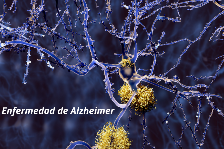 Enf. de Alzheimer un desafío en salud